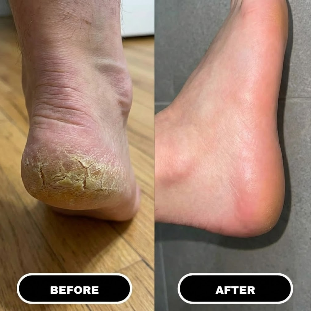 Foot Relief Stick