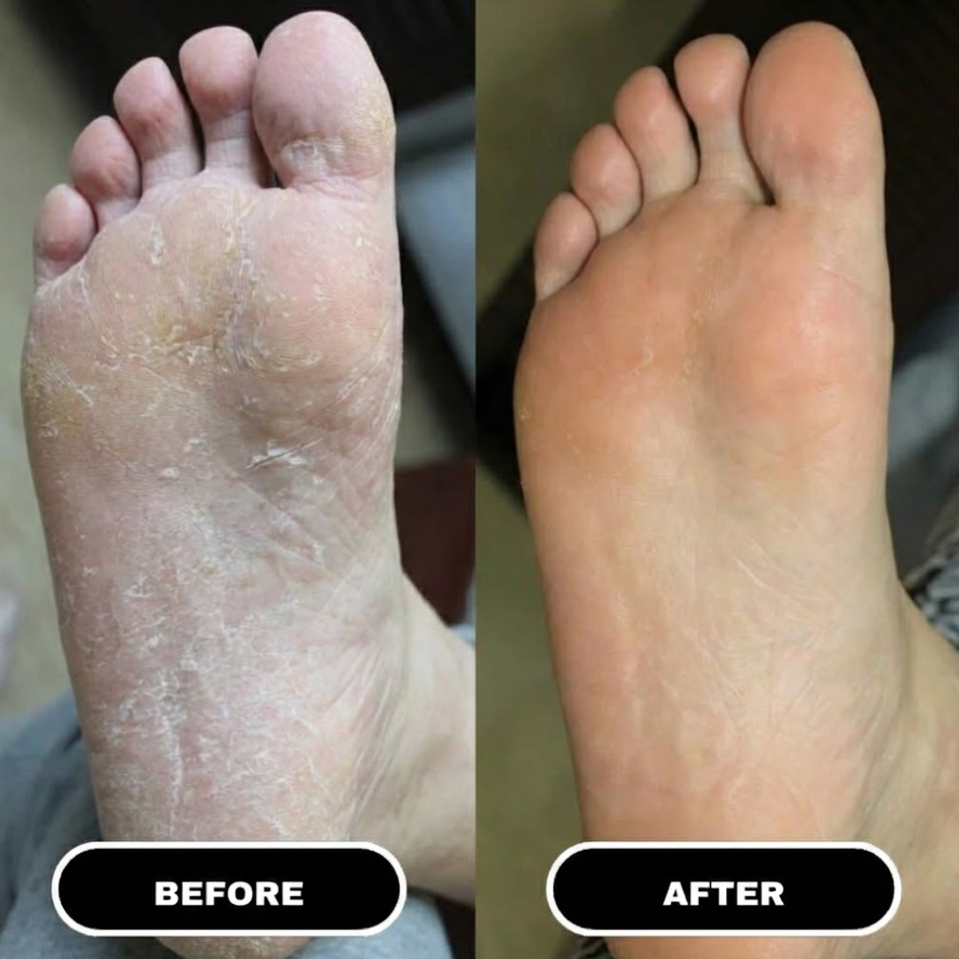 Foot Relief Stick