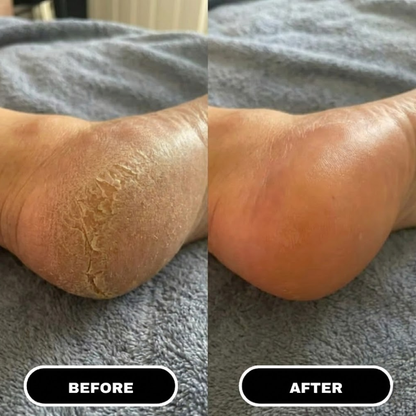 Foot Relief Stick